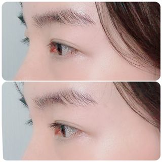 더소설 소설 블랙아이래쉬 세럼 10g(SOSEOL BLACK EYELASH SERUM 10g) — 4점을 준 리뷰어가 2023년 12월 올린 사용 사진