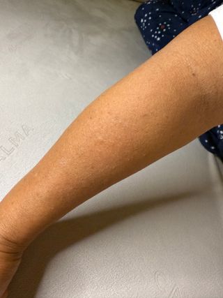 프리 [닥터문] 프리미엄 알로에베라 시카 수딩젤 1000ml — 5점을 준 리뷰어가 2024년 12월 올린 사용 사진