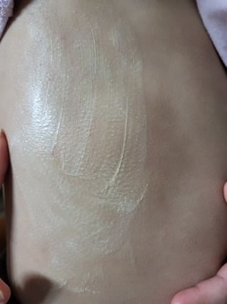 건선/아토/습진/민감성 피부 천연보습진정크림 소리온 크림 & 센시티브 크림 50g — 5점을 준 리뷰어가 2022년 1월 올린 사용 사진