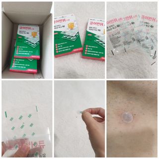 [큐어반H 스팟] 자외선 99프로 차단되는 스틱타입 스팟밴드(1팩 / 66매입) — 4점을 준 리뷰어가 2022년 11월 올린 사용 사진