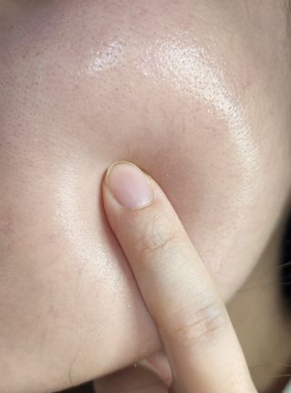 난나 살몬 스파이더 검버섯 미백 톤업 화이트닝 연어 앰플 크림 300ml 대용량 — 5점을 준 리뷰어가 2022년 8월 올린 사용 사진