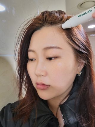바이브랩 [탈모증상완화] 헤어라인 눈썹 두피앰플 — 5점을 준 리뷰어가 2022년 3월 올린 사용 사진