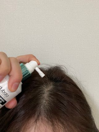 모두발라 탈모집중케어 헤어토닉 — 5점을 준 리뷰어가 2021년 12월 올린 사용 사진