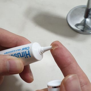 히루스카 포스트아크네 클리어 — 5점을 준 리뷰어가 2021년 1월 올린 사용 사진