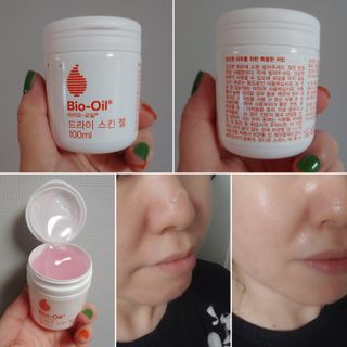 바이오오일 [바이오-오일] 드라이 스킨 젤 100ml — 5점을 준 리뷰어가 2021년 8월 올린 사용 사진