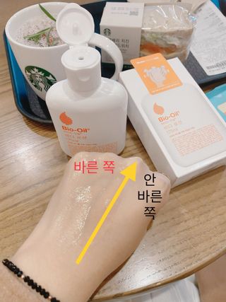 바이오오일 [바이오-오일] 바디 로션 175ml — 5점을 준 리뷰어가 2021년 11월 올린 사용 사진