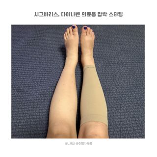 시그바리스 다이나벤 의료용 압박 스타킹 [종아리형] 여름철 다리 붓기 관리 하지정맥류 예방 — 3점을 준 리뷰어가 2024년 8월 올린 사용 사진