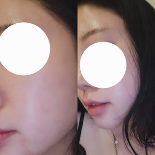 스킨1004 [SKIN1004] 마다가스카르 센텔라 라이트 클렌징 오일 200ml — 5점을 준 리뷰어가 2024년 7월 올린 사용 사진