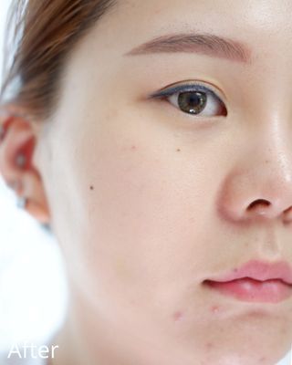 아이디플라코스메틱 페이스핏 플라스터 마스크 _ 리뉴얼 — 5점을 준 리뷰어가 2021년 7월 올린 사용 사진