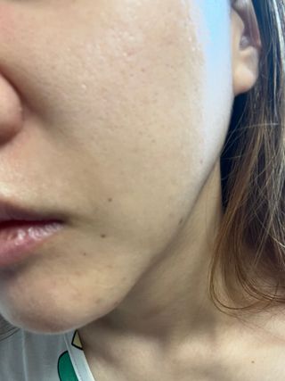 📷프리 (인스타체험단) [밀리밀리] 메디 앰플 비타 15ml — 5점을 준 리뷰어가 2025년 10월 올린 사용 사진