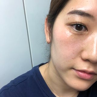 브에노 스킨셀 더마 앰플 — 5점을 준 리뷰어가 2021년 6월 올린 사용 사진