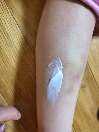 젠바이오 코스메틱스 젠바이오수딩크림]   가려운 피부 & 아토피 원픽 크림 — 5점을 준 리뷰어가 2022년 9월 올린 사용 사진