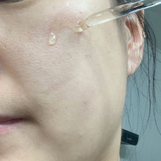 [스킨1004] 마다가스카르 센텔라 앰플 100ml — 4.5점을 준 리뷰어가 2024년 5월 올린 사용 사진