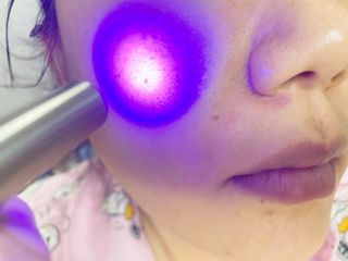 메데스 비츠케어 모공케어 피부관리키트 — 2점을 준 리뷰어가 2021년 7월 올린 사용 사진