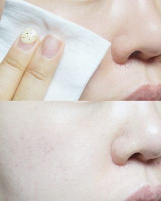 나나스킨 하이드로릴렉싱토너 — 5점을 준 리뷰어가 2021년 5월 올린 사용 사진