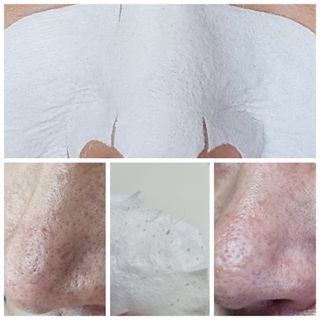 세뚜아(Cettua) 세뚜아 스티키 포어 패치 Cettua Sticky Pore Patch — 5점을 준 리뷰어가 2023년 7월 올린 사용 사진