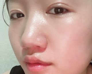리더스코스메틱 리더스 카밍 바이오틱스 #1등 진정 기획세트 [에센스 워터150ml + 크림 마스크80ml] — 5점을 준 리뷰어가 2022년 9월 올린 사용 사진