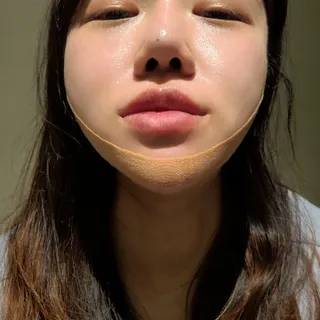 아이디플라코스메틱 아이디 페이스핏 마이너스 밴드 v2 — 5점을 준 리뷰어가 2022년 5월 올린 사용 사진