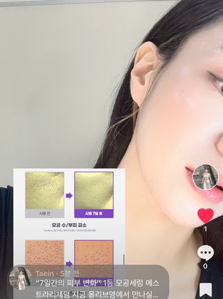 틱톡 캠페인 ★ ｜ Tiktok x 0.8L 에스트라리제덤 (최종_방문형) — 5점을 준 리뷰어가 2024년 10월 올린 사용 사진