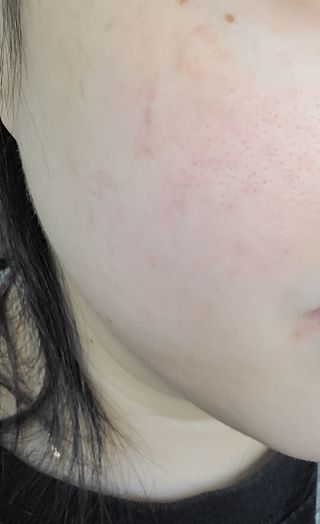 브에노 스킨셀 더마 앰플 — 5점을 준 리뷰어가 2021년 6월 올린 사용 사진
