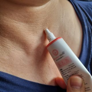 작심연구소 바르는 피부과 레이저 메디스팟크림 플러스 — 4.5점을 준 리뷰어가 2022년 7월 올린 사용 사진