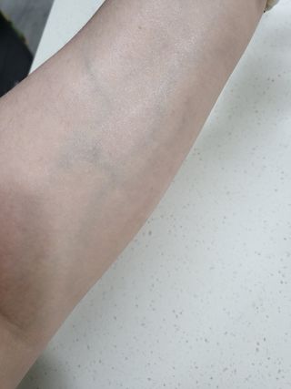 [프레시오] 아르니카 수딩 진정 앰플 — 5점을 준 리뷰어가 2022년 4월 올린 사용 사진