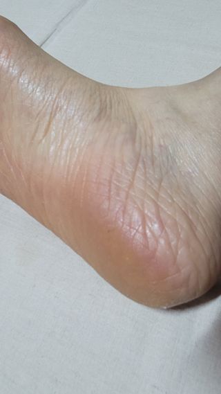 파랑새41님이 올린 리뷰 사진 4