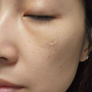 세뚜아(Cettua) 세뚜아 스팟 클리어 듀얼 패치 Cettua Spot Clear Dual Patch — 5점을 준 리뷰어가 2023년 11월 올린 사용 사진