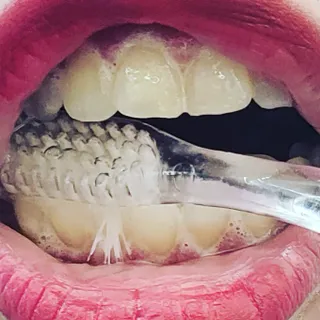 닥터데디스  잇몸치약 100g  [건강한 잇몸 관리를 위한 치약] + 여행용미니치약 15g — 5점을 준 리뷰어가 2022년 7월 올린 사용 사진