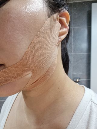 아이디플라코스메틱 아이디 페이스핏 마이너스 밴드 v2 — 5점을 준 리뷰어가 2021년 10월 올린 사용 사진