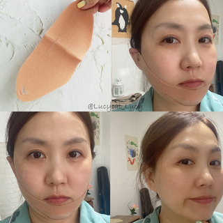아이디플라코스메틱 아이디 페이스핏 마이너스 밴드 v2 — 4점을 준 리뷰어가 2021년 5월 올린 사용 사진