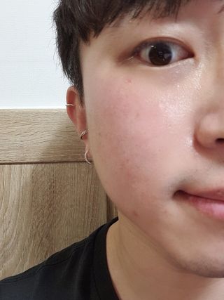 셀바이져 지우개 미스트 피부 보호 입주변 트러블 진정 케어 아기 안개분사 미스트 — 4점을 준 리뷰어가 2021년 3월 올린 사용 사진