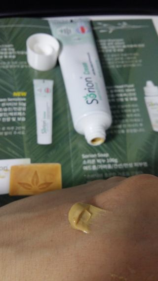 건선/아토/습진/민감성 피부 천연보습진정크림 소리온 크림 & 센시티브 크림 50g — 5점을 준 리뷰어가 2022년 1월 올린 사용 사진