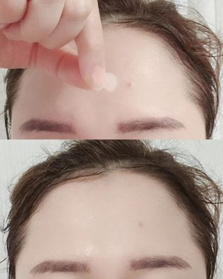 세뚜아(Cettua) 세뚜아 스팟 클리어 듀얼 패치 Cettua Spot Clear Dual Patch — 5점을 준 리뷰어가 2023년 9월 올린 사용 사진