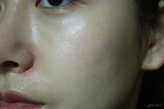 바이리뮤 에이지 홀딩 펩타톡스 앰플 — 5점을 준 리뷰어가 2021년 4월 올린 사용 사진
