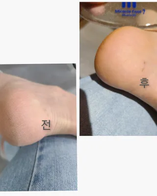 까꿍님이 올린 리뷰 사진 2