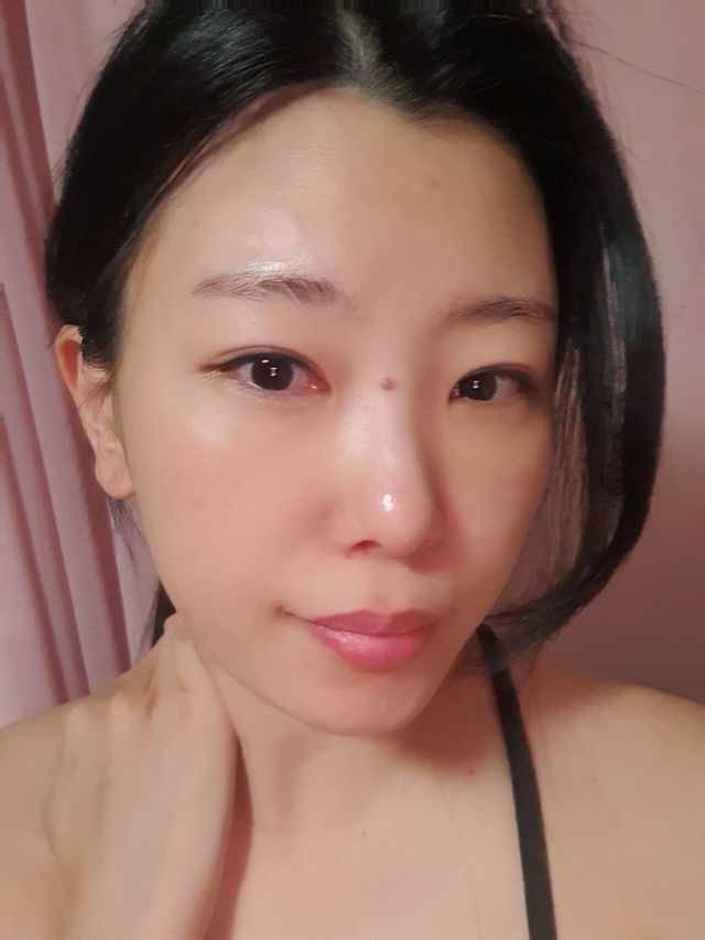 제로 트러블 패치 27ea 리뷰 사진