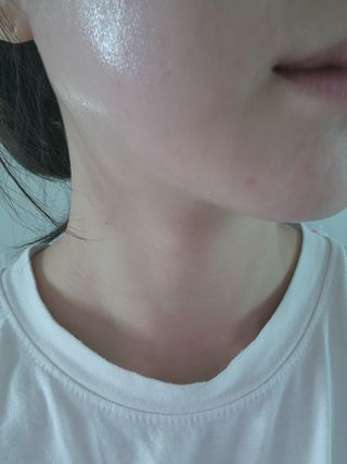 키노닉스 포텐틸라 카밍 크림 토너 — 5점을 준 리뷰어가 2022년 2월 올린 사용 사진