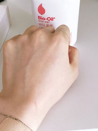바이오오일 [바이오-오일] 바디 로션 175ml — 5점을 준 리뷰어가 2021년 9월 올린 사용 사진