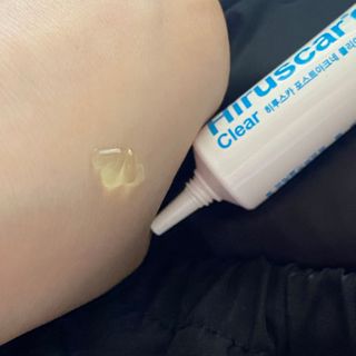 히루스카 포스트아크네 클리어 — 5점을 준 리뷰어가 2020년 12월 올린 사용 사진