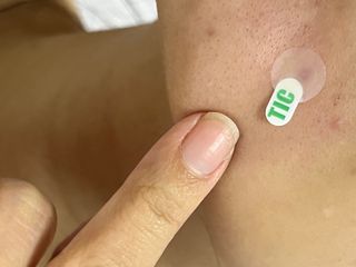 [큐어반H 스팟] 자외선 99프로 차단되는 스틱타입 스팟밴드(1팩 / 66매입) — 5점을 준 리뷰어가 2022년 11월 올린 사용 사진