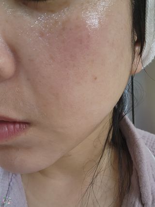 디에이브 더마-테카 바이옴 크림 50ml — 5점을 준 리뷰어가 2023년 3월 올린 사용 사진