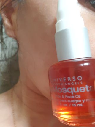 유니베르소 로즈힙 오일 15ml — 5점을 준 리뷰어가 2021년 8월 올린 사용 사진