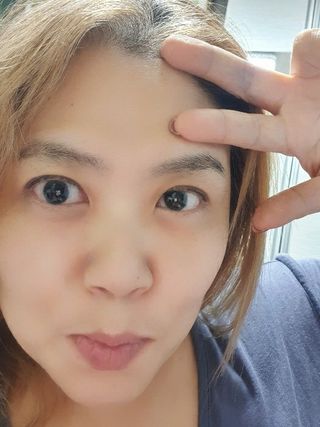 히루스카 포스트아크네 클리어 — 5점을 준 리뷰어가 2020년 12월 올린 사용 사진