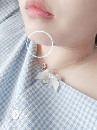 세뚜아(Cettua) 세뚜아 스팟 클리어 듀얼 패치 Cettua Spot Clear Dual Patch — 5점을 준 리뷰어가 2023년 5월 올린 사용 사진