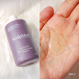 스칼프메드 레드캡슐바이옴 두피케어 프로바이오틱스 유산균 두피관리 세트 — 5점을 준 리뷰어가 2021년 4월 올린 사용 사진