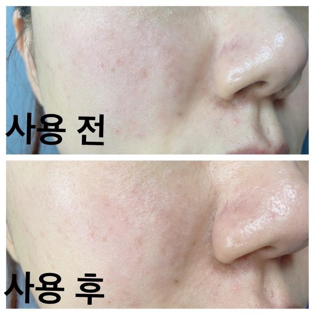 블레미쉬 카밍 오일 세럼 리뷰 사진