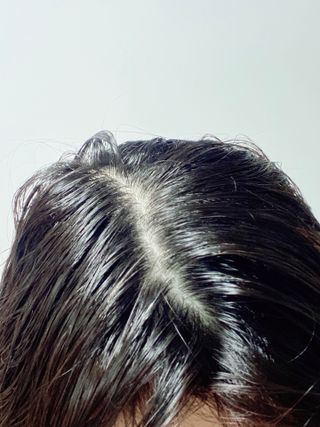 닥터시드 티트리 앤 라임 비건 지성케어 쿨 탈모 두피 워터 스케일러 — 4점을 준 리뷰어가 2024년 5월 올린 사용 사진
