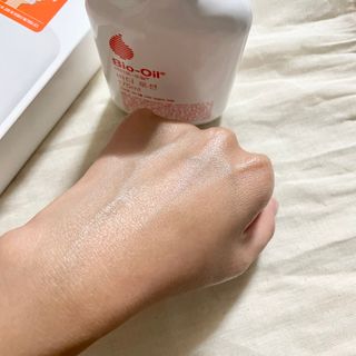 바이오오일 [바이오-오일] 바디 로션 175ml — 4점을 준 리뷰어가 2021년 10월 올린 사용 사진