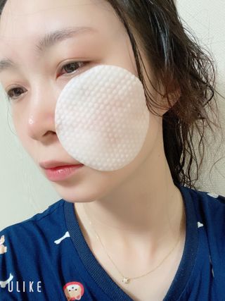 메디필 레드 락토 콜라겐 필링패드 — 5점을 준 리뷰어가 2021년 3월 올린 사용 사진